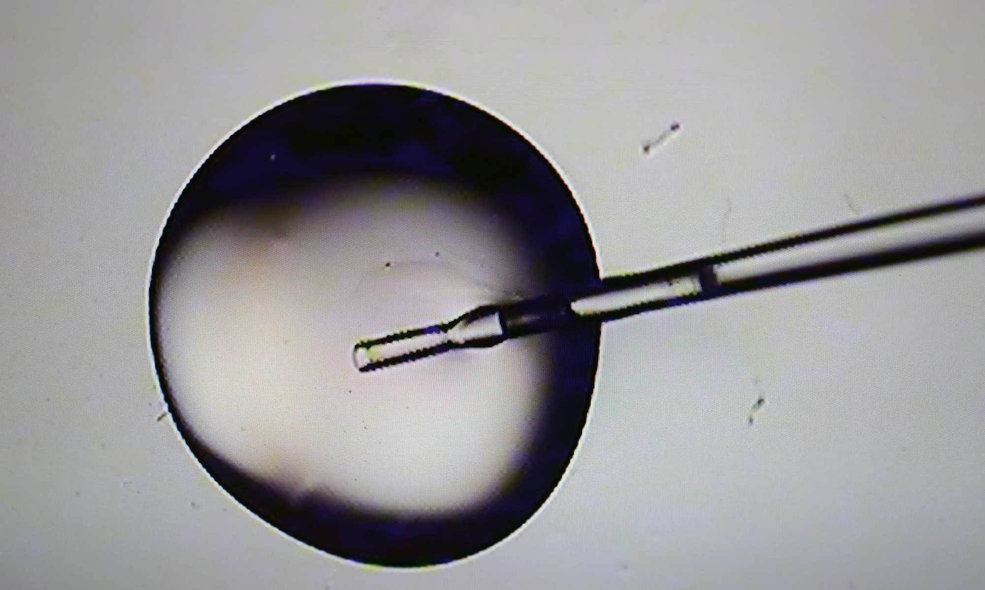 A view of a cryo solution during embryo prep seen with a microscope at an IVF lab at the Brigham & Women's Hospital in Boston in 2024.